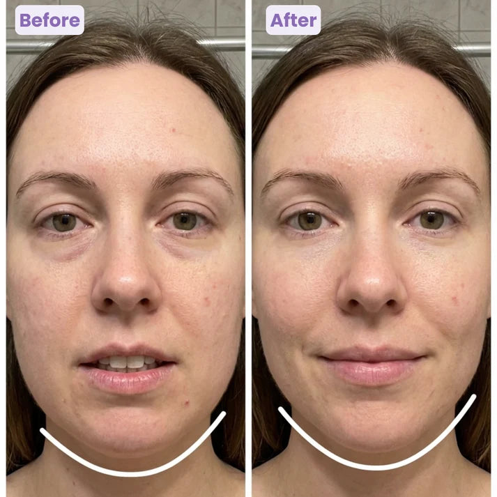 Lymphatic Drainage Facial Brush